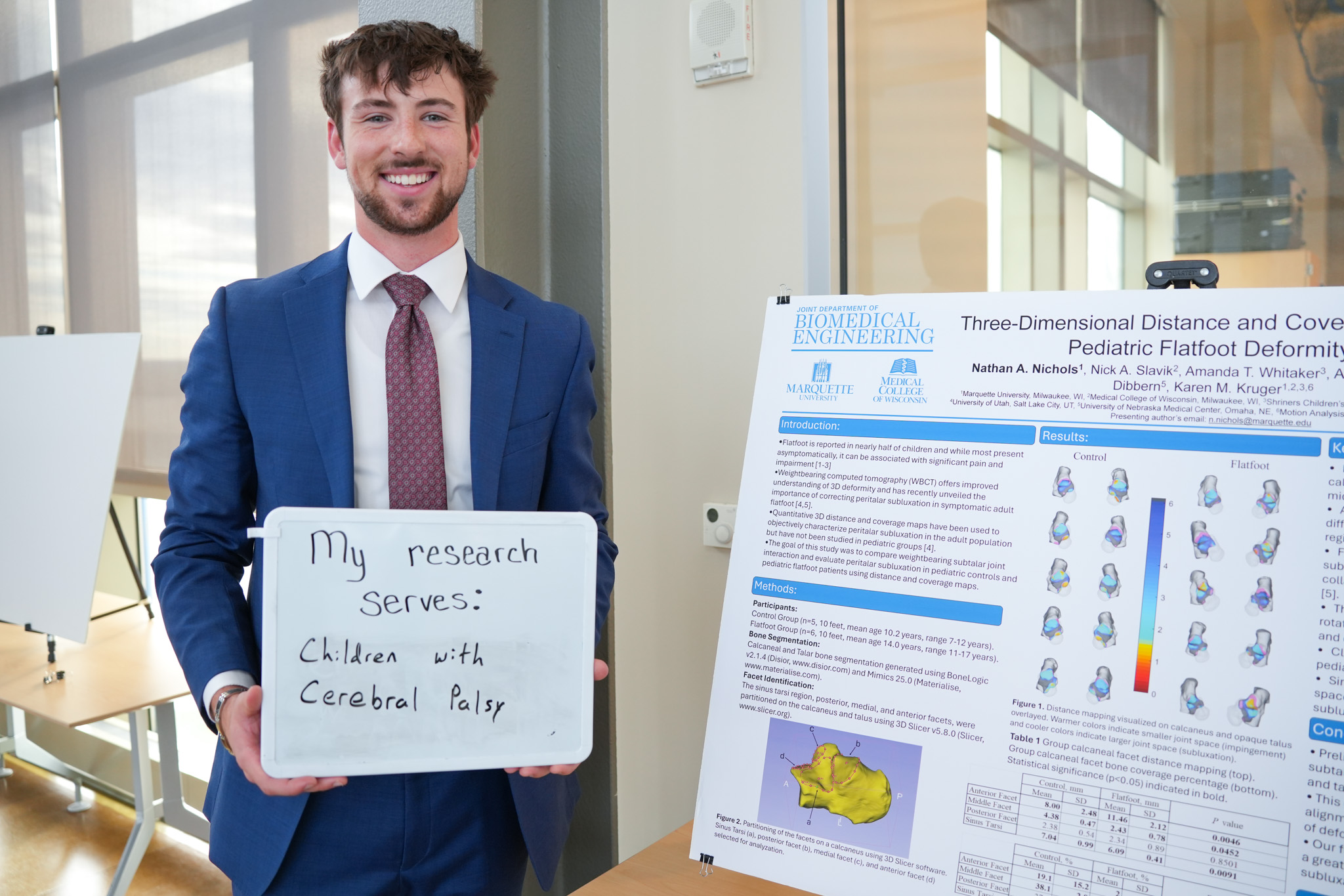student holding a board that says "my research serves: children with cerebral palsy" in front of a research poster