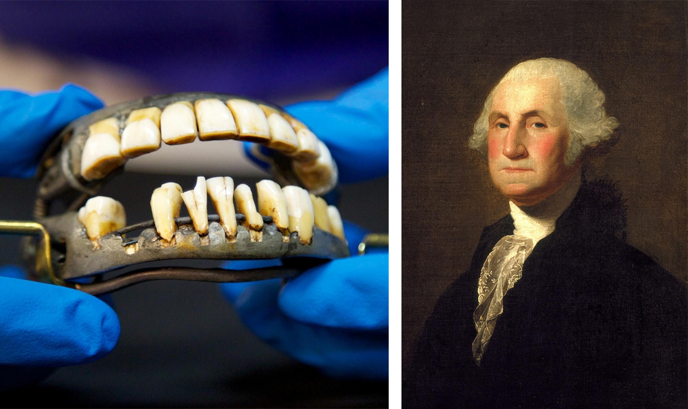 What did dental care look like 250 years ago? | Marquette Today