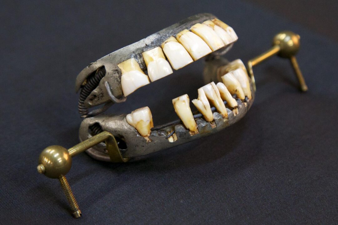 dentures-7-3-2013-shenk-157